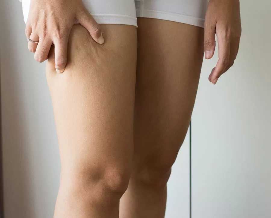 crema anti celulitis