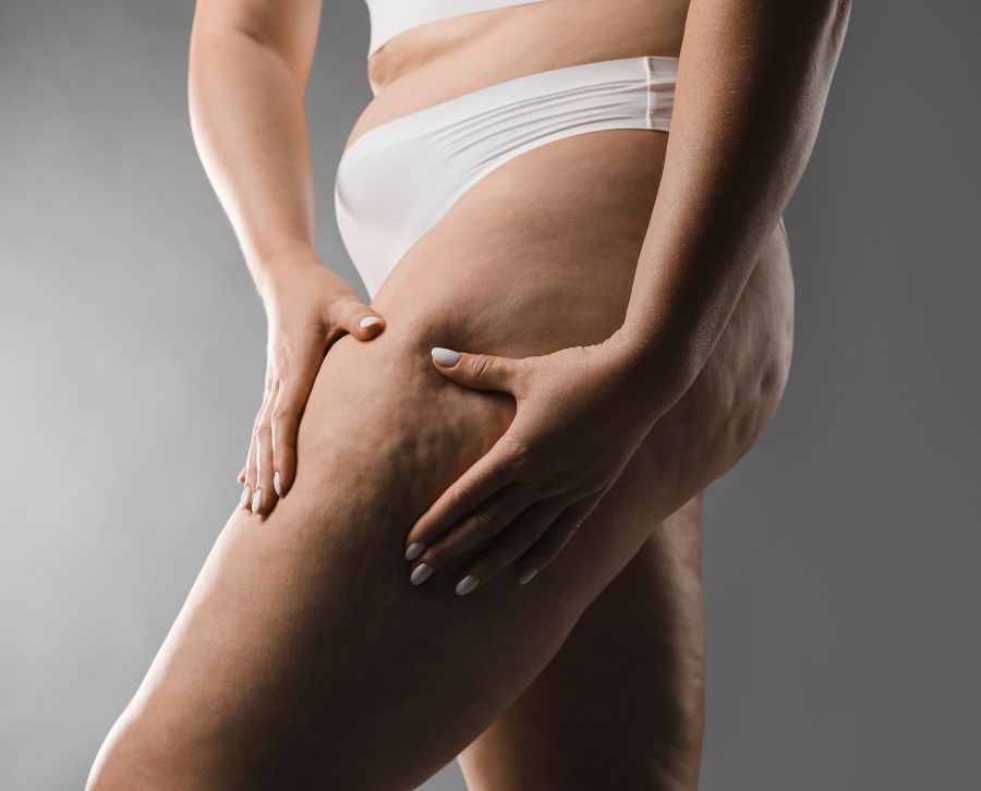 dieta para la celulitis